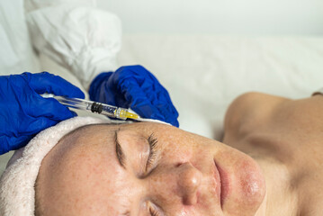 Needle mesotherapy in a beauty clinic. Cosmetics are injected into the woman's face