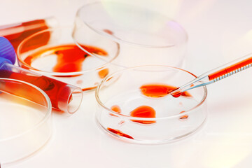 Medical laboratory. Coronavirus blood sample COVID-19. Petri dish and test tubes with blood in the laboratory. Blood coronavirus test.Virus vaccine development.Pipette and petri dish.Virus research.