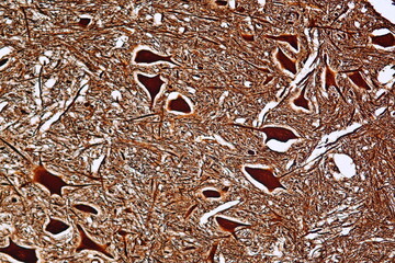 Motor Neuron and nerve cells under the microscope in Lab.