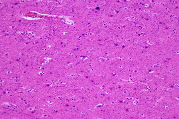 Motor Neuron and nerve cells under the microscope in Lab.