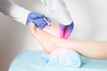 Doctor orthopedist makes an injection with blockade medication for cartilage regeneration and...