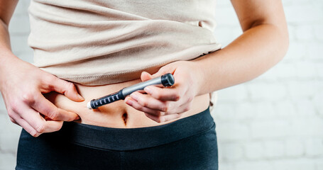 A woman injects insulin with insulin injection device into the subcutaneous tissue of abdomen - obrazy, fototapety, plakaty