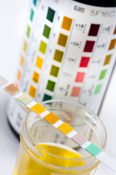 Urine Self-Tests-Self-Measurement close up view