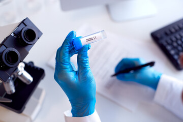 Close Up Of Lab Worker Doing Test Using Microscope Holding Test Tube Labelled Positive And Negative