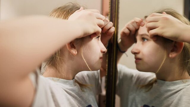 Young teenager girl squeezing acnes on skin face front mirror. Portrait of a teenager with problem skin. Girl teenager squeezes pimples on her face. Youth skin care.