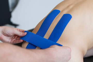 Physical therapist applying blue kinesio tape on male patient's lower back. Kinesiology, physical therapy, rehabilitation concept. - obrazy, fototapety, plakaty