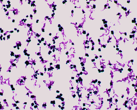 micrococcus luteus gram stain