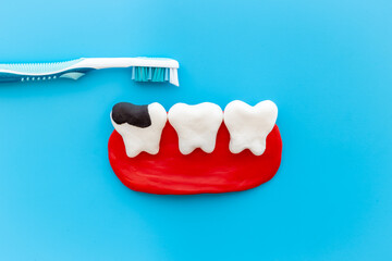 Teeth models with caries or plaque and toothbrush. Oral health concept