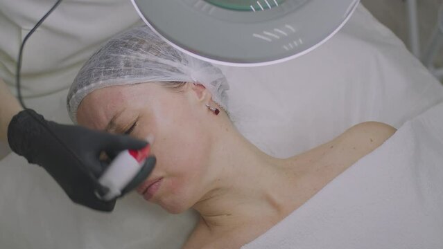 Close-up of a woman face. Needle mesotherapy procedure into the skin of the face