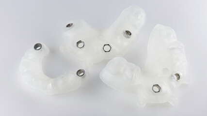 great composition of three surgical Dental templates for total implantation of the upper and lower...