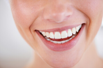 Smile a while. Close up of a woman's sparkling teeth.