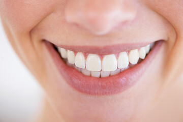 Dazzling smile. Close up of a woman's sparkling teeth.