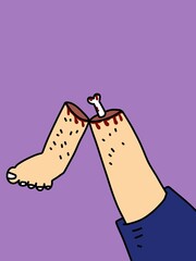 broken leg cartoon on purple background