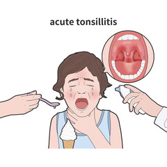 급선 편도염에 체온측정하는 아이 메디컬일러스트