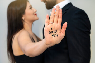 Romantic portrait of young couple in love hug. I just got engaged. Shallow depth of field and hand...
