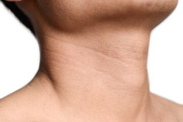 Aging skin folds or skin creases or wrinkles at neck of Asian old man. Concept of sore throat,...