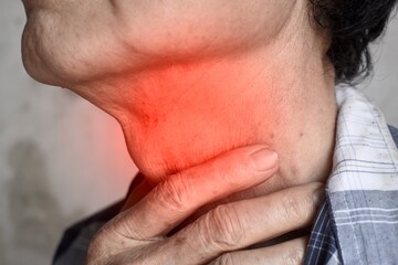 Redness at neck of Asian man. Concept of sore throat, pharyngitis, laryngitis or dysphagia.