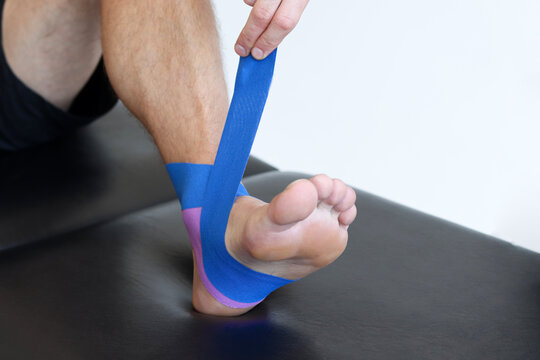 Kinesiology taping treatment with blue tape on male patient injured foot. Sports injury kinesio treatment. - Powered by Adobe