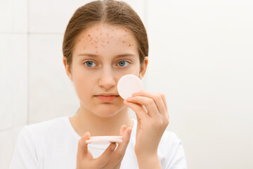 face of a teenage girl, she looks at herself in the mirror and takes care of her skin, does...