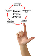 Steps in  Vicious Cycle of Arthritis