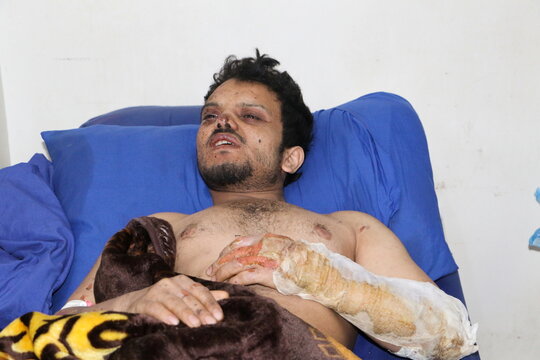 Man injured by air strikes on a detention center lies on a hospital bed in Saada