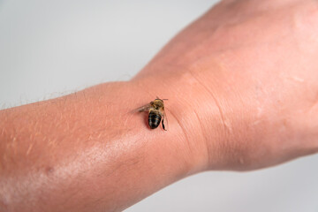 A bee on a man's hand.