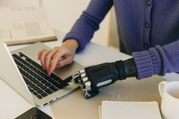 Crop shot of female typing on keyboard in artificial bionic arm prosthesis, dressed in veri peri...