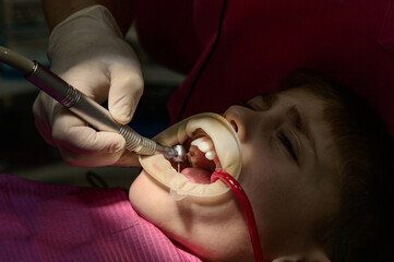 Dentist cleans tooth decay in a child with a drill, in the child's mouth ejector saliva.