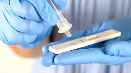 Hand of doctor drops reagent onto coronavirus (Covid 19) antigen test kit, medical concept, and infection screening