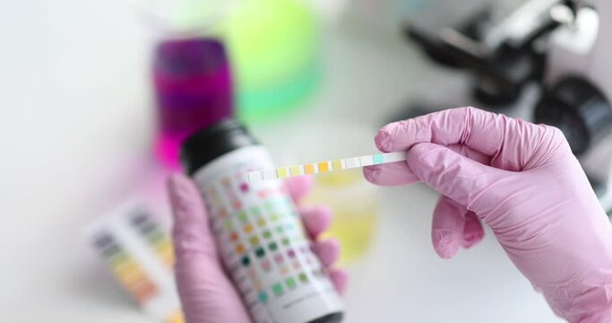Doctor holding test strip with indicators of different colors for urinalysis closeup 4k movie