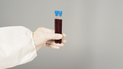 Hands are holding two blood test tubes on grey background. Hand wears a PPE suit and a white...