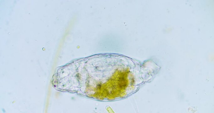 Protozoa protists unicellular organism microorganism Paramecium in a drop of water microcosmic background. 3 different magnification levels 80x , 200x , 800x
