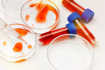 Medical laboratory. Coronavirus blood sample COVID-19. Petri dish and test tubes with blood in the laboratory. Blood coronavirus test.Virus vaccine development.Pipette and petri dish.Virus research.