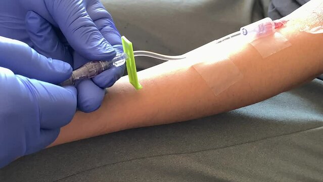 Hands in blue gloves connect Intravenous to catheter in patient's arm