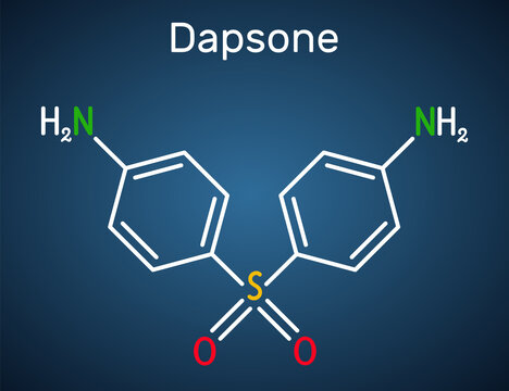 Dapsone, diaminodiphenyl sulfone, DDS molecule. It is sulfone antibiotic for the treatment of leprosy and dermatitis herpetiformis. Structural chemical formula on the dark blue background