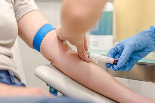 Close-up Of Doctor Taking Blood Sample From Patient's Arm in Hospital for Medical Testing.