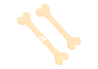 illustration of broken bones and normal bones