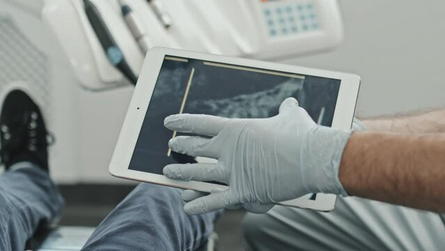 Over-shoulder of unrecognizable patient sitting in dentist chair in modern clinic, looking at tablet computer with image of dental X-ray in hands of cropped doctor at daytime