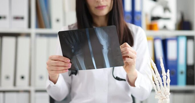 Doctor traumatologist looking at xray of hand on background of artificial model of human palm 4k movie slow motion