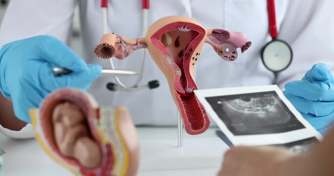 Doctor explaining changes in ovaries to patient on artificial model of uterus and showing ultrasound picture 4k movie