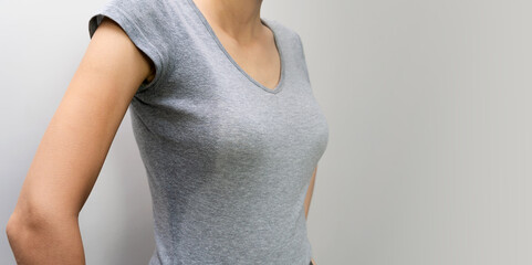 Close-up of a young woman in a gray shirt with hyperhidrosis, sweating. Young Caucasian woman with...
