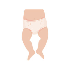 baby with diaper rash. Redness of the skin in the groin and abdomen. Allergy to sorbent, irritation. Dermatological problems. Isolated image on a white background. Vector illustration, flat - obrazy, fototapety, plakaty