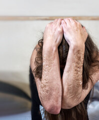 Woman, arms and hands held protective over the head, with heavy Cuts and scars of self-mutilation...
