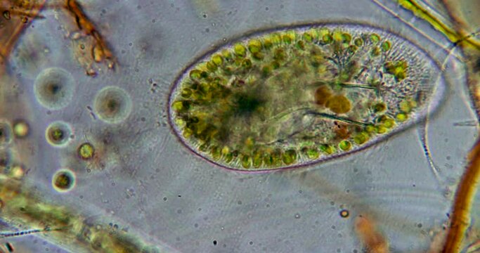 Protozoa protists unicellular organism under microscope Euglena, Paramecium and amoebas 800x magnification
