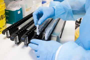 Sorting blood tubes into racks in the analysis laboratory