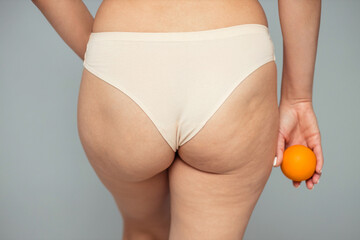 Young woman holding an orange on a light background. Cellulite problem concept  