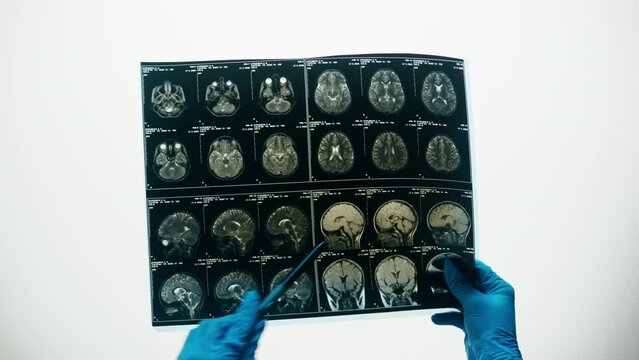 X-ray, Magnetic resonance image of head. Doctor examining human brain MRI close-up. Advanced research of body, checkup tomography. 