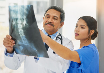 Seeing right through to the problem. Shot of a mature doctor and young nurse looking at an x ray together.