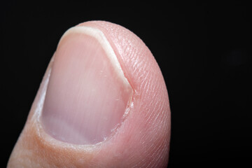 Close-up of male fingertips with nails. Photo in soft focus at high magnification.