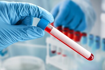 Researcher hold blood sample for New Variant of the Covid-19. Doctor in analysis lab